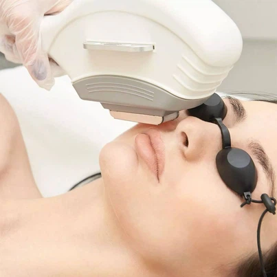 laser beauty laser beauty